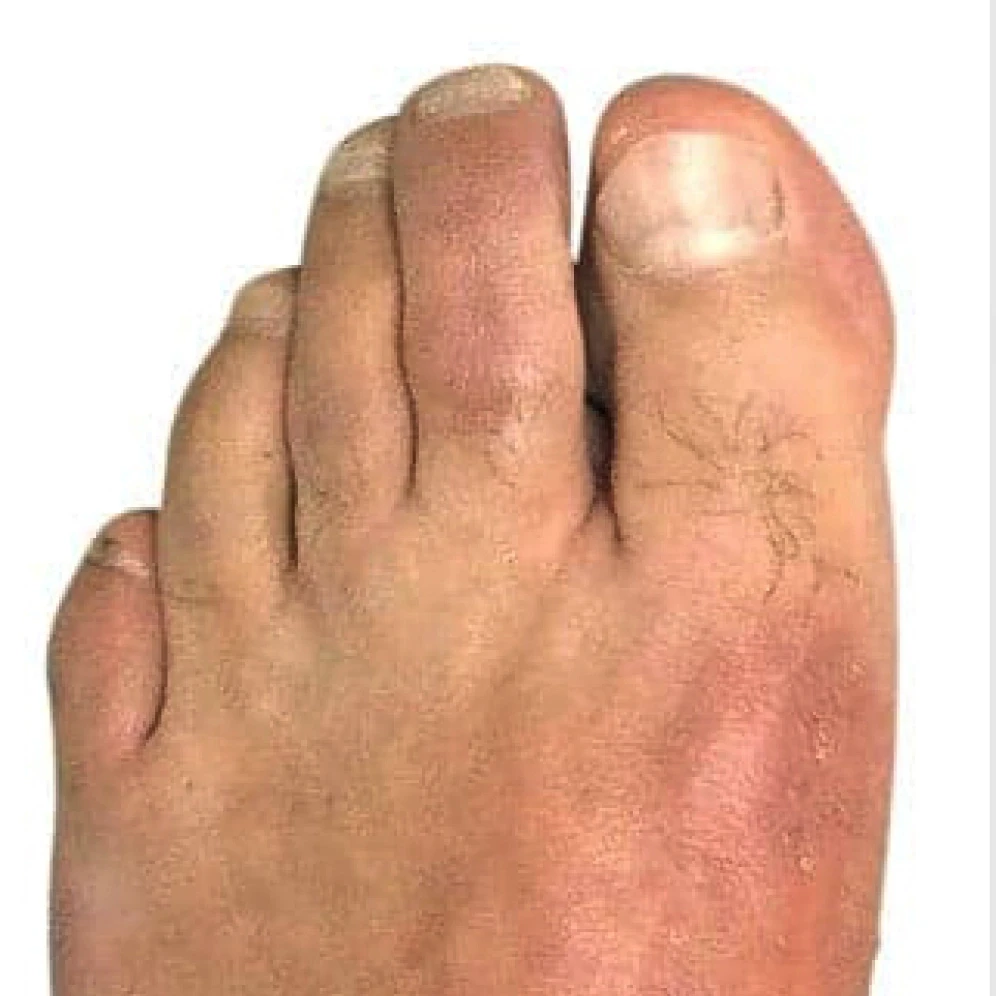 foot1