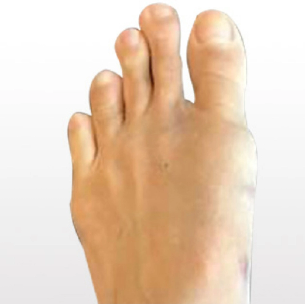 foot4