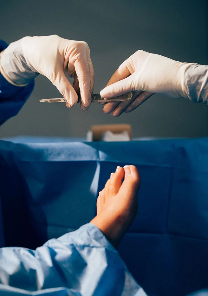 A close-up of a surgical scene shows two hands, wearing sterile white gloves, holding a scalpel. One hand grips the blade, while the other holds the handle. A light-skinned foot with light-colored nails rests on a dark blue surgical drape. The setting appears to be a sterile operating room with light blue surgical attire visible on the person. The background features a muted gray-toned wall. - LapiFusion Lapidus Procedure in New York, NY