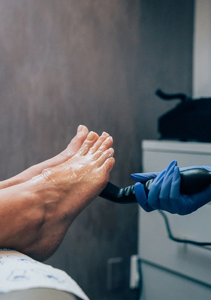 Close-up of a foot receiving a medical treatment. A gloved hand applies a substance from a tube to the foot while it rests on a medical table. The background includes medical equipment. - UltraSound in New York, NY