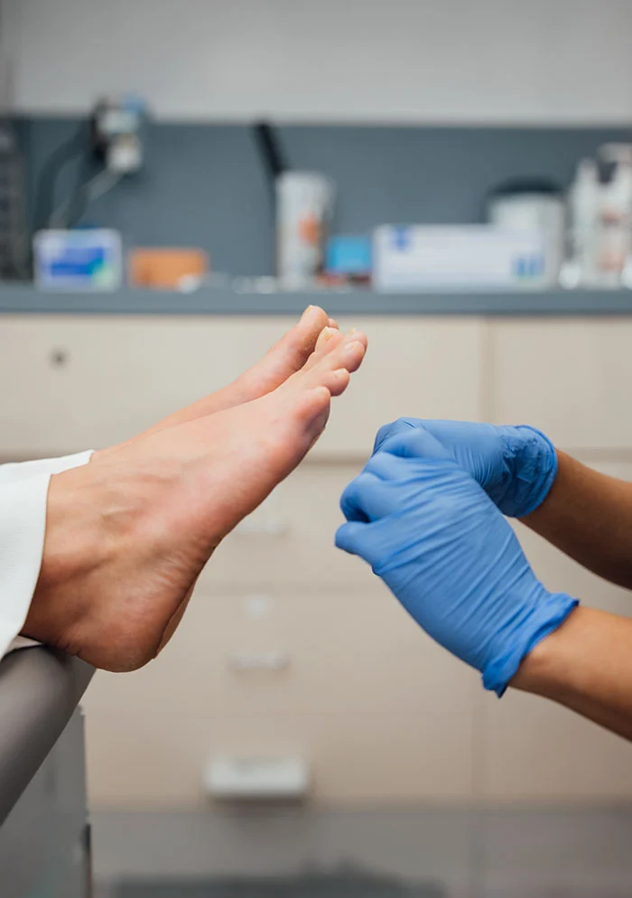 A close-up view of a patient's feet resting on an examination table during a medical assessment. A healthcare professional, wearing blue nitrile gloves, carefully examines the patient's feet, demonstrating a focus on meticulous patient care. The blurred background with medical equipment suggests a professional and well-equipped clinic setting. - Wart Therapy in New York, NY