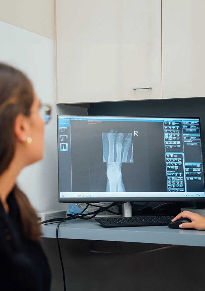 A dedicated medical professional, likely an orthopedic specialist, carefully analyzes a leg X-ray on a computer monitor in a modern clinic. The physician, wearing eyeglasses and a dark blouse, examines the grayscale image, likely assessing a lower leg or ankle injury. The well-lit workspace features a computer with diagnostic tools, a keyboard, and a mouse, suggesting a focus on accurate diagnosis and effective treatment planning. - Xray in New York, NY